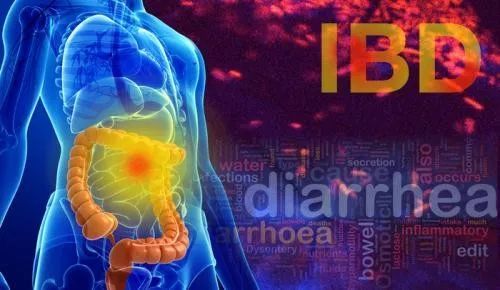 IBD: 体重指数不影响乌司他单抗在克罗恩病中的临床疗效