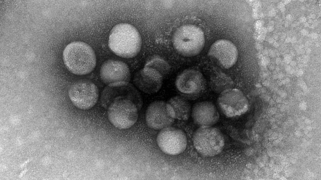 Science：发现两种全新的可感染人类的冠状病毒，分别来自狗和猪