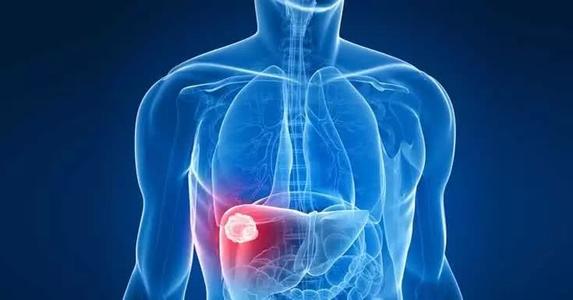 BMC Gastroenterology：原发性肝细胞癌手术切除时机对老年患者生存结局的影响