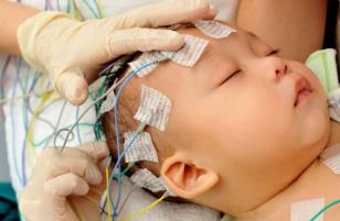 新生儿蓝光治疗仪注册审查指导原则