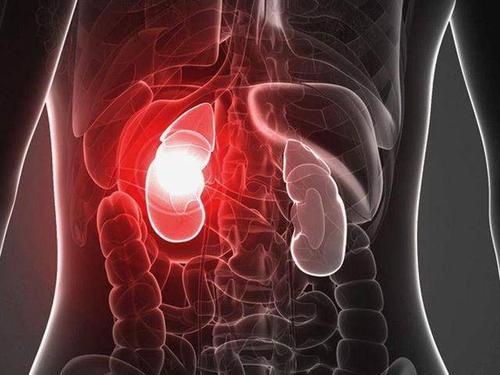 Clin Trans Gastroenterology：尿中性粒细胞明胶酶相关脂质运载蛋白（NGAL）可作为肝硬化急性肾脏损伤的诊断和预后指标