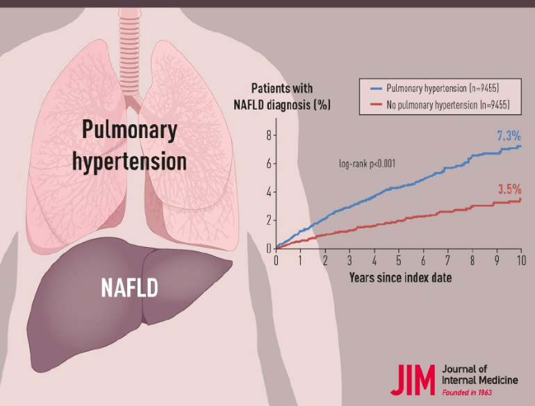 J INTERN MED：<font color="red">肺动脉</font>高压与NAFLD发病率增加相关