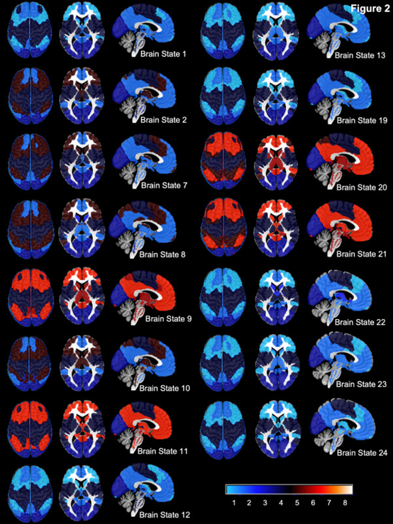 NeuroImage：老年人脑状态21的脑干水平的网络同步存在<font color="red">年龄</font>相关的弱化