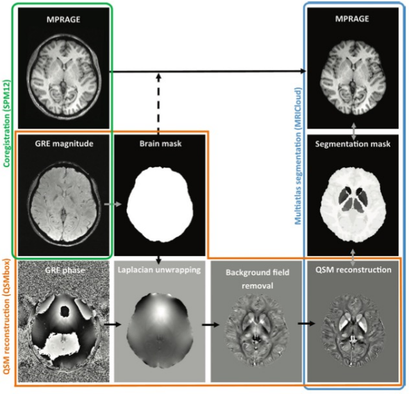 Radiology：哪些MRI表现与Wilson病的临床<font color="red">严重</font>程度有关？