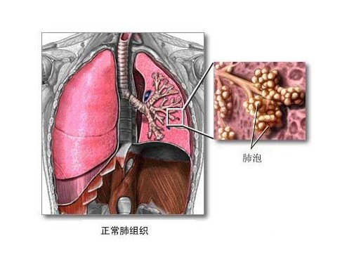 Immunity：二甲双胍显示出治疗COVID-19<font color="red">肺部</font>炎症的前景