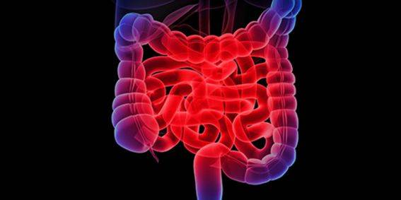 Clin Gastroenterology H:低脂肪高纤维饮食可减少溃疡性结肠炎患者的肠道炎症