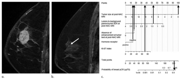 Radiology:如何应用影像学预测乳腺癌NAC后的pCR？
