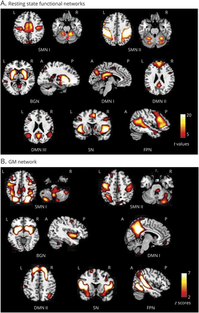 Neurol Neuroimmunol Neuroinflamm: 结构<font color="red">和</font>功能MRI网络可预测<font color="red">多发性</font><font color="red">硬化症</font>临床恶化