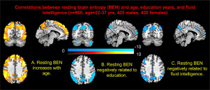 NeuroImage：静息态功能磁共振成像估计脑熵的神经认知相关性