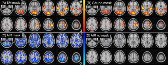 NeuroImage:戴口罩对fMRI <font color="red">BOLD</font>的影响