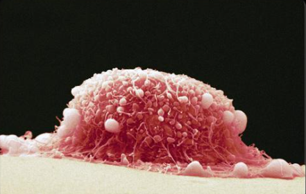 Br J Cancer：去泛素化酶USP9X：口腔癌的潜在治疗靶标
