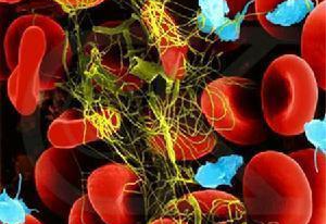 Leukemia：鲁索替<font color="red">尼</font>治疗骨髓纤维化<font color="red">贫血</font>患者的新型治疗策略的有效性和安全性研究