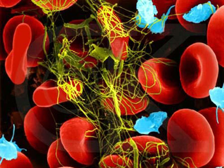 Nat Commun：<font color="red">血液</font><font color="red">凝固</font>机制的发现对新的抗血栓药物研发有了新进展