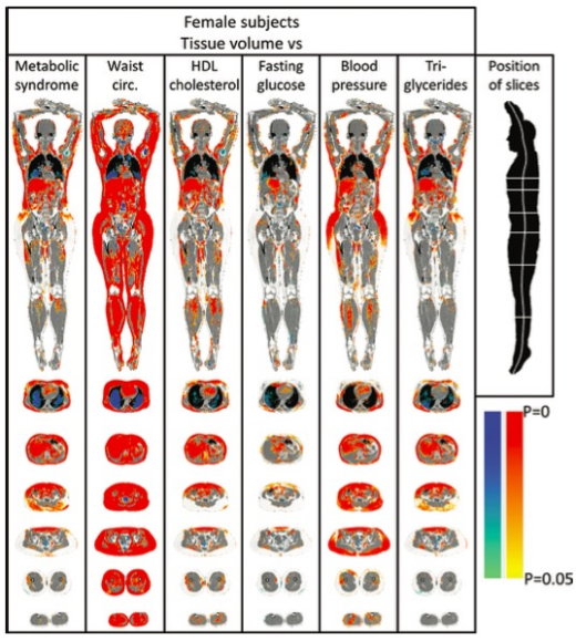 Radiology：这一影像学技术，揭开了代谢综合征的“肥胖面纱”！