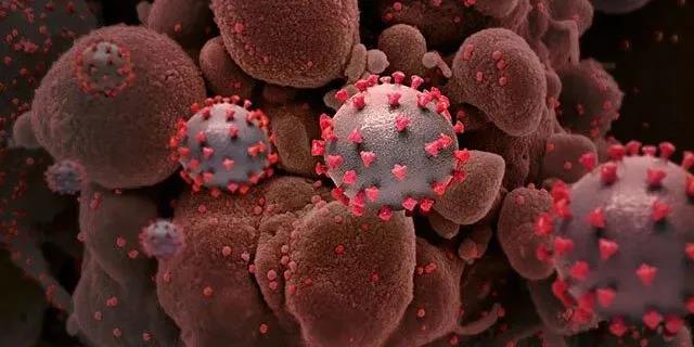 MedRxiv：新冠病毒在艾滋病患者体内快速突变，导致新冠病毒加速进化、更加强大