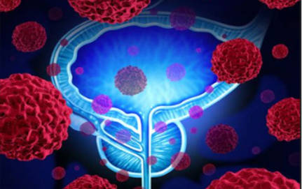Nat Commun：EZH2甲基化ERG K362位点并增强前列腺癌中TMPRSS2-ERG的<font color="red">致癌</font>活性
