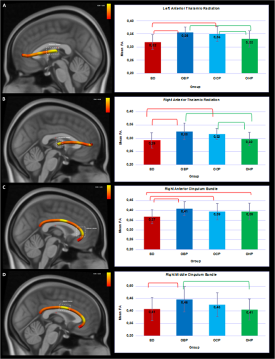 Neuropsychopharmacol:双侧丘脑<font color="red">前</font>辐射FA值高是BD的保护因素