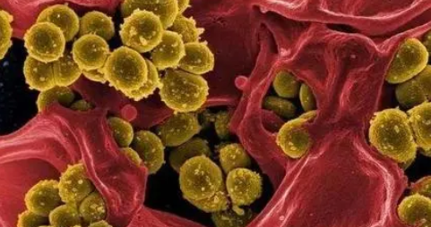 Blood：FXII在金葡菌感染诱导的器官衰竭和死亡中的致病作用
