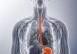 Gastric Cancer：胃<font color="red">食管</font>肿瘤的脑转移：被低估的并发症