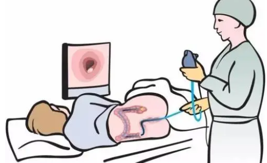 Endoscopy：结肠镜检查的质量和并发症发生率