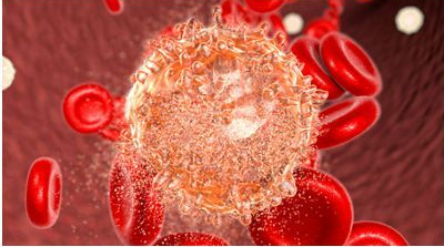 Nat Med：靶向<font color="red">CD</font><font color="red">19</font>和<font color="red">CD</font>22的双特异性CAR-T疗法可治疗复发性/难治性<font color="red">B</font>细胞恶性肿瘤