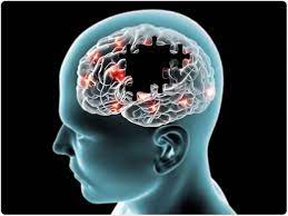 AD患者的脑<font color="red">细胞</font>过度消耗对神经传递至关重要的资源