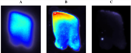  Eur J Nucl Med Mol Imaging ：一种新型高灵敏度阿尔茨海默病β-淀粉样蛋白<font color="red">PET</font>示踪剂：[18F]DRKXH1