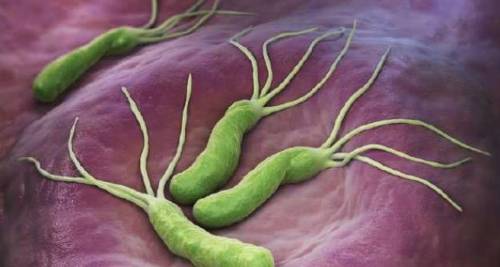JGH：持续性感染幽门螺杆菌3年以上会导致血清同型半胱氨酸浓度升高