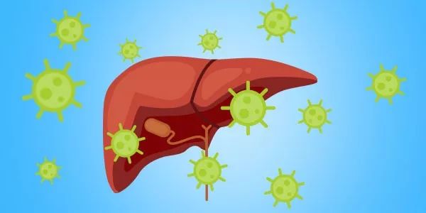 Dig Dis Sci：肥胖和糖尿病均可影响丙型肝炎患者直接抗病毒治疗后的效果