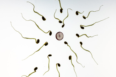 Nature Communications :精子运动可以帮助诊断和治疗男性不育症