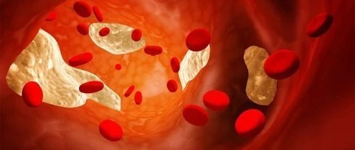 Science揭秘：这种胆固醇，让肝脏疾病有救了！