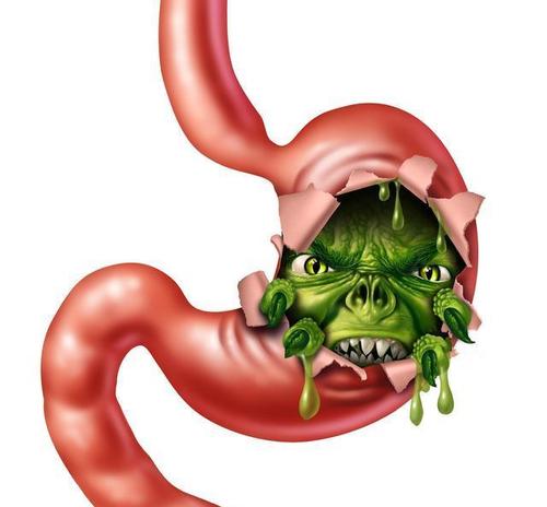 Clinical &Translational Gastroenterology: PFKFB3 过表达在胃癌进展中具有强烈的负面影响