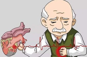 Circulation：心绞痛在稳定型<font color="red">冠状动脉</font><font color="red">疾病</font>患者中的发生情况及对其预后的预测意义