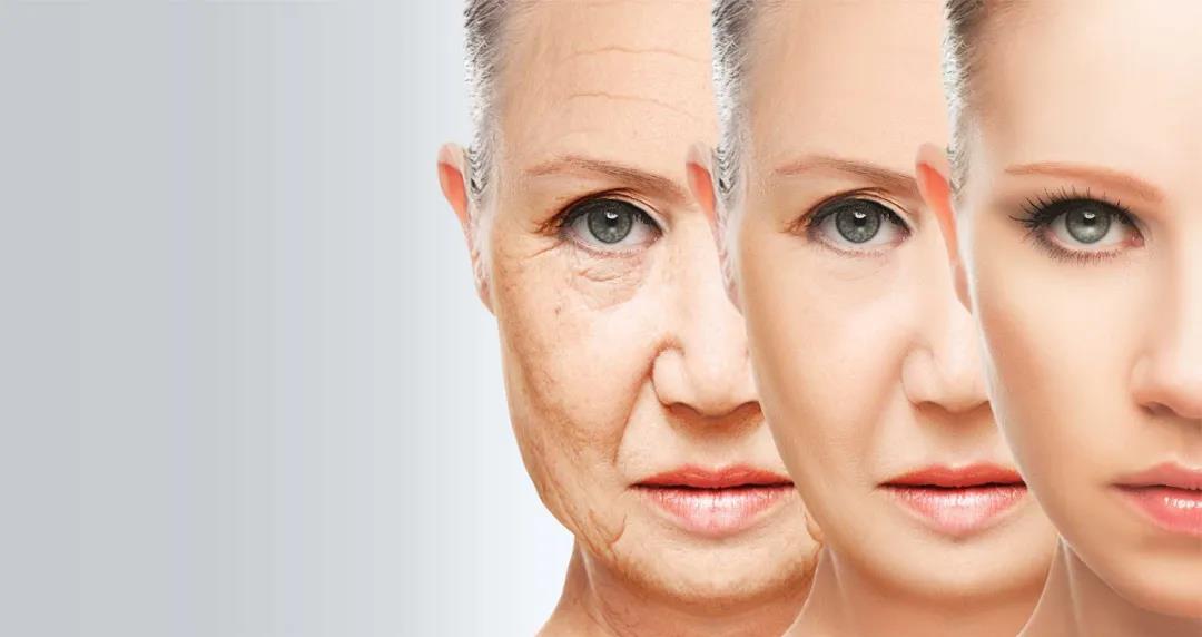 Nature Aging：张亮/李青峰团队发现防止脱发和皮肤老化的新靶点