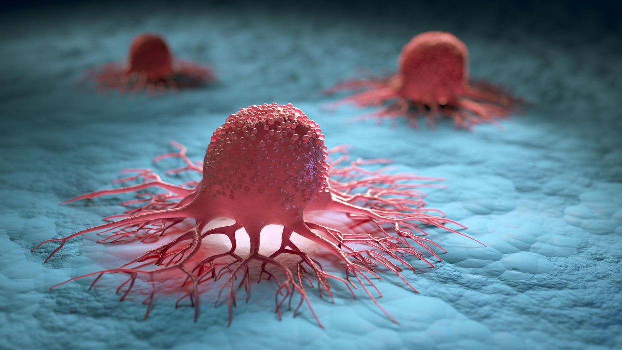 Cancer Cell：序贯组合疗法可以使治疗对侵袭性癌症患者更有效！