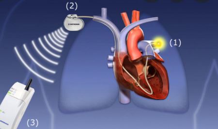 Lancet：血流动力学指导下的心力衰竭管理，或许并不能降低死亡率