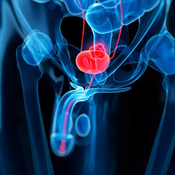 AJG：抑酸药雷尼替丁可能会诱发膀胱癌的发生！