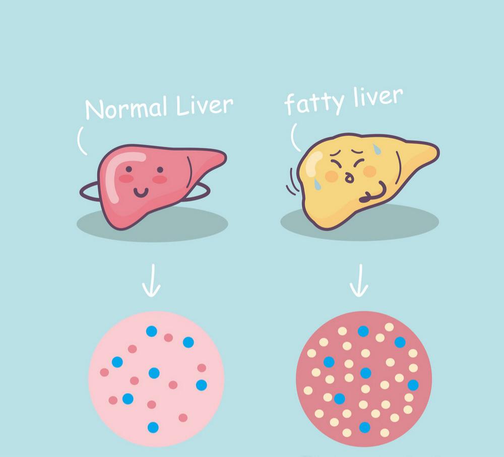 九转黄精丹：改善高脂饮食引起的代谢功能障碍相关脂肪肝