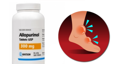 EHJ：“两大金刚”别嘌呤醇与苯溴马隆在痛风患者中的相关心血管风险