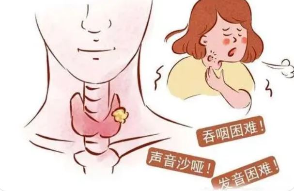 Clin Cancer Res：乐伐替尼相比安慰剂将中国放射碘难治性甲状腺癌患者的生存期延长了约 6 倍！
