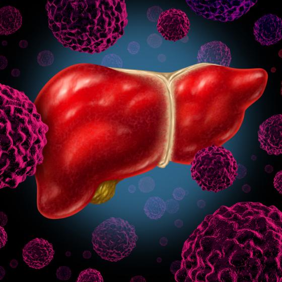 Clin Gastroenterology H: HBeAg 对慢性乙型肝炎患者口服抗病毒药物治疗期间肝细胞癌风险的影响