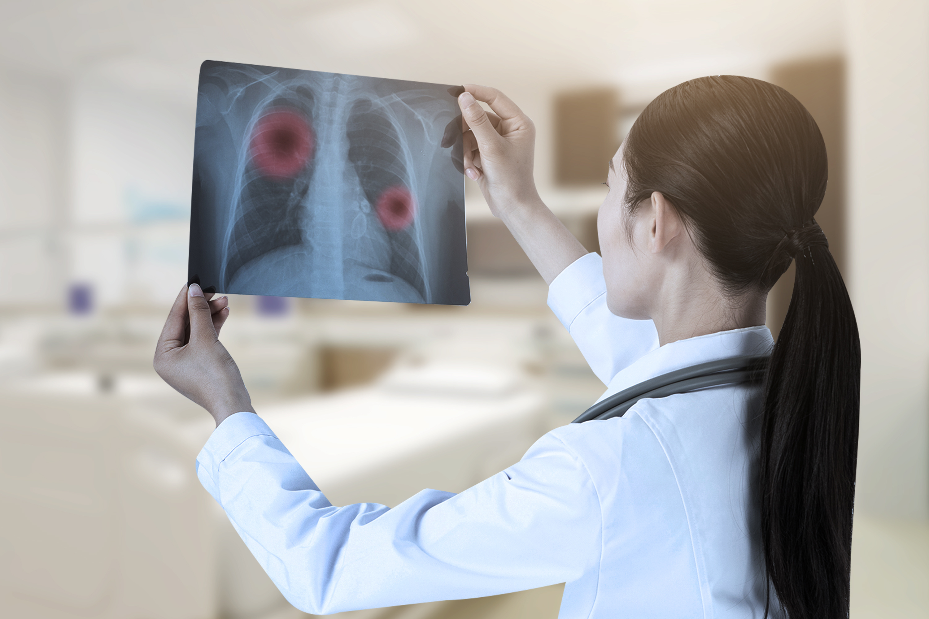 集中式方法能够提高患者肺癌筛查依从性