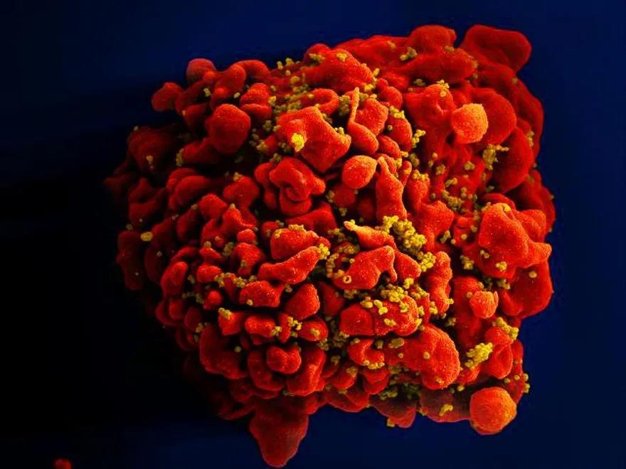 Nat Commun：彻底治愈艾滋病的曙光：FDA首次批准CRISPR<font color="red">基因</font><font color="red">编辑</font>治疗艾滋病人体临床试验