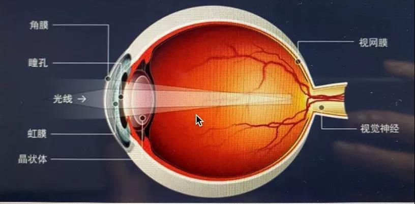 <font color="red">白内障</font>，是我国致盲率最高的眼部疾病！如何预防？怎么治疗？