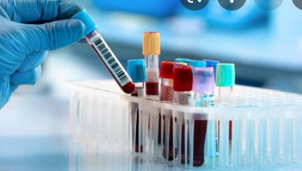 PLOS MED：通过简单的血液<font color="red">测试</font>就能进行癌症调查？一项开发、内部验证和净收益分析