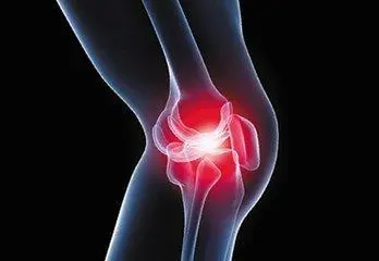 Journal of Physiotherapy ：患者<font color="red">教育</font>可改善膝骨关节炎患者的疼痛和功能，与运动疗法结合使用效果更佳 ！