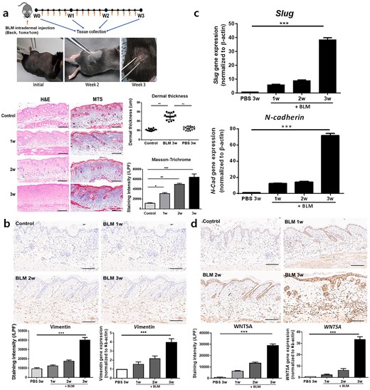 Bunrs & Trauma：WNT5A 在瘢痕疙瘩发病机制中通过 JAK/STAT 途径促进IL-6依赖性上皮-间充质转化