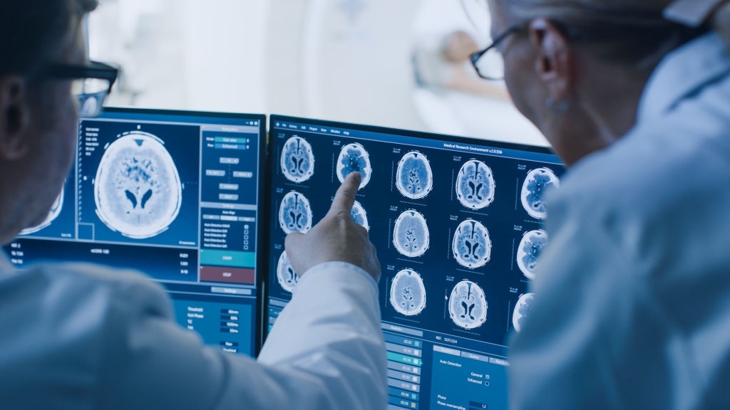 Annals of Neurology：MRI研究：淋巴改变是AD认知功能障碍的媒介