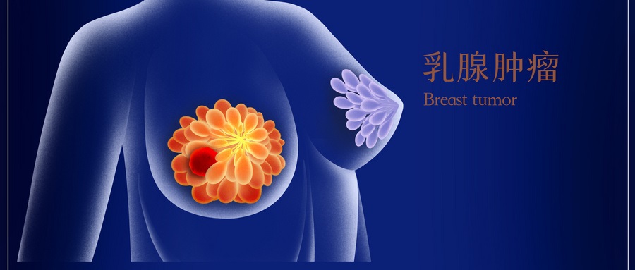 European Radiology：MRI对新辅助化疗乳腺癌患者病理完全缓解的预测