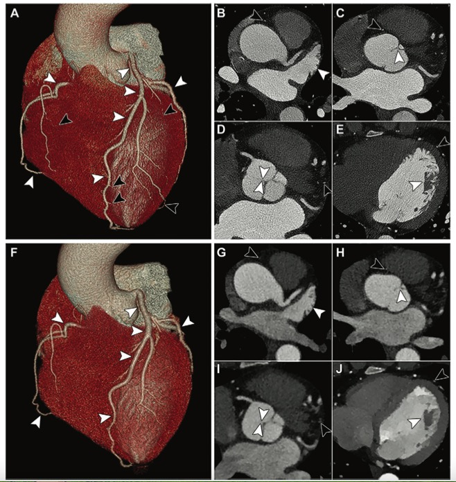 Radiology：光子计数:<font color="red">CT</font><font color="red">成像</font>的下一个时代?